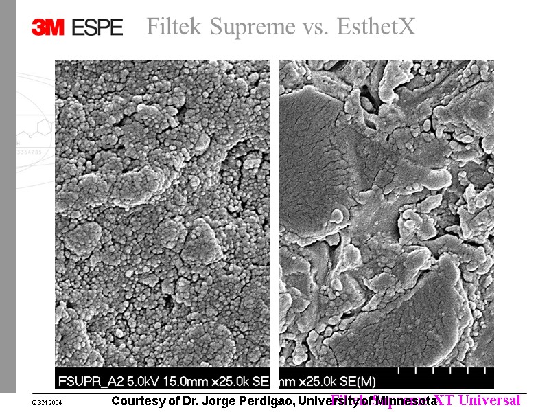 Filtek Supreme vs. EsthetX Courtesy of Dr. Jorge Perdigao, University of Minnesota Filtek Supreme vs. EsthetX Courtesy of Dr. Jorge Perdigao, University of Minnesota